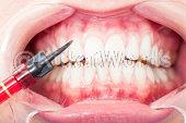 Dentition Image