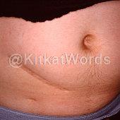 abdominal Image