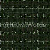 oscillate Image